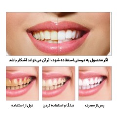 سرم سفید کننده دندان مدل LANBENA